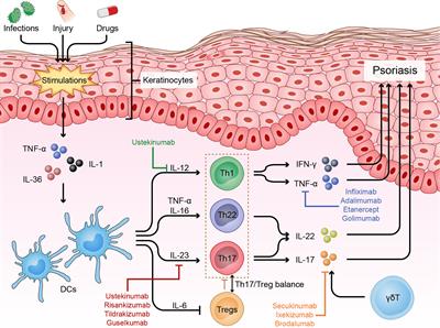 The Role of Helper T Cells in Psoriasis